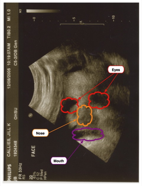 Ultrasound Interpretation_1