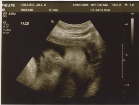 Baby Callies Ultrasound 2_1